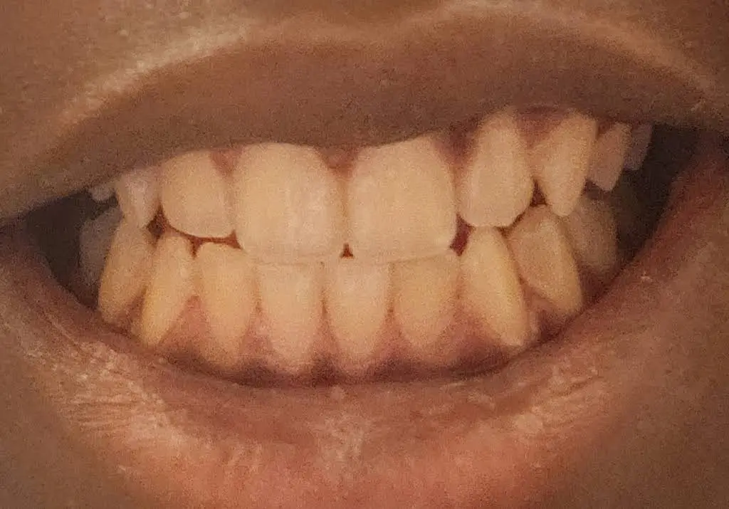 Craig Ranch Dental Group