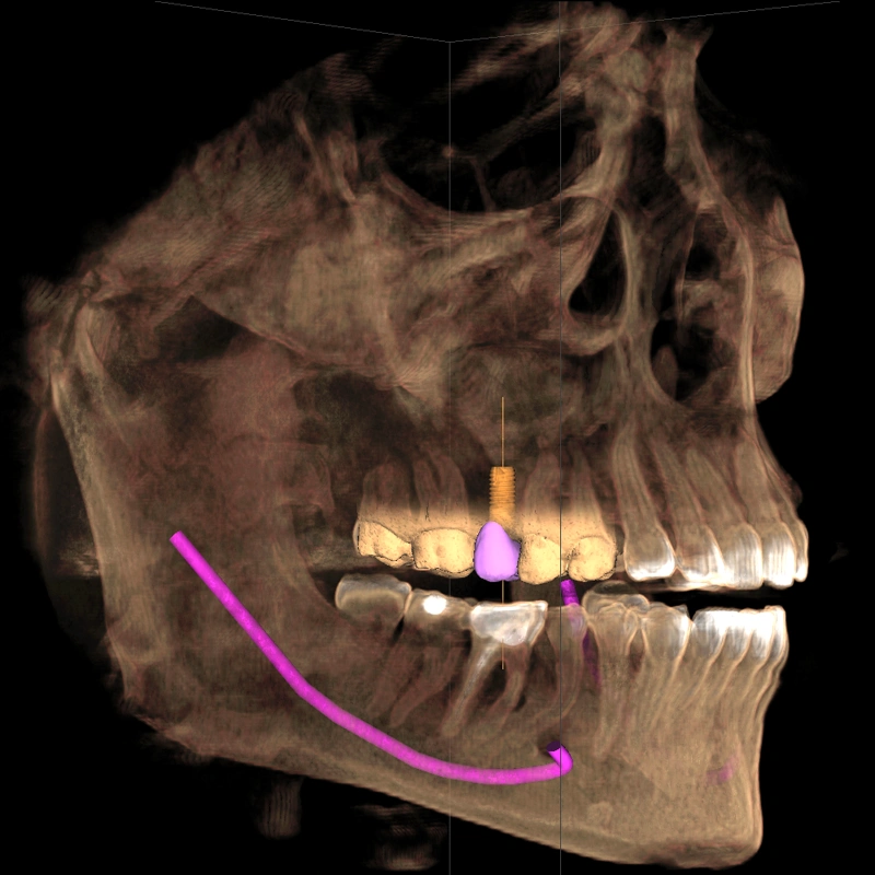 Lakemoor Dental & Orthodontics of Elk Grove Village