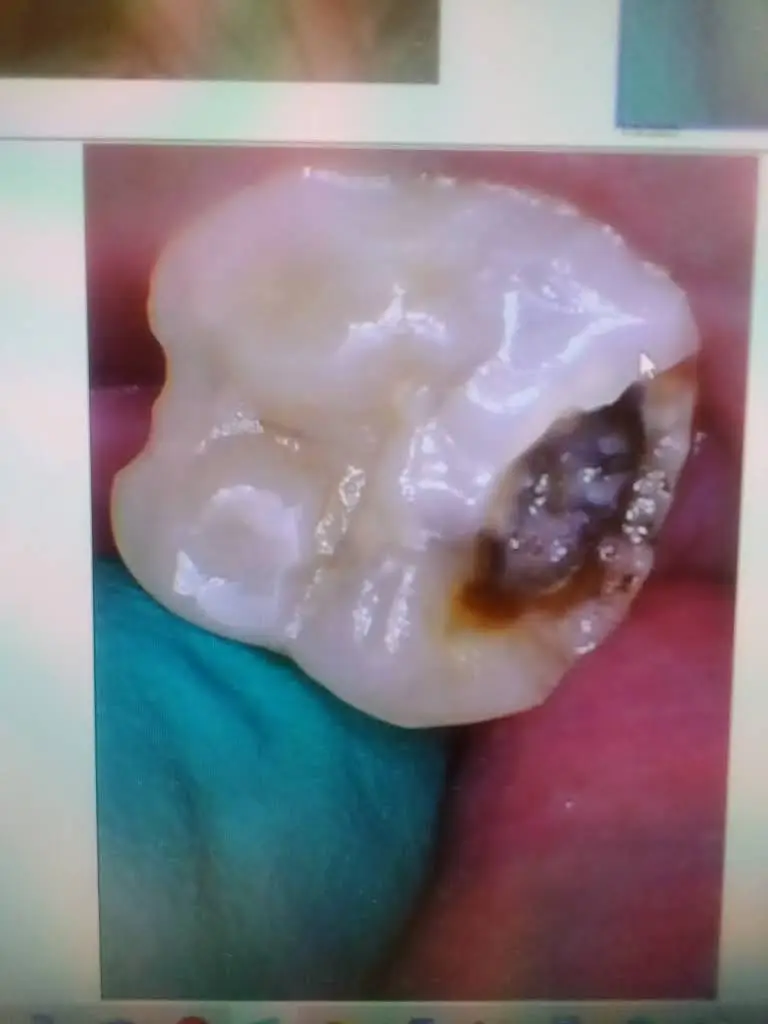Wood Dale Dental