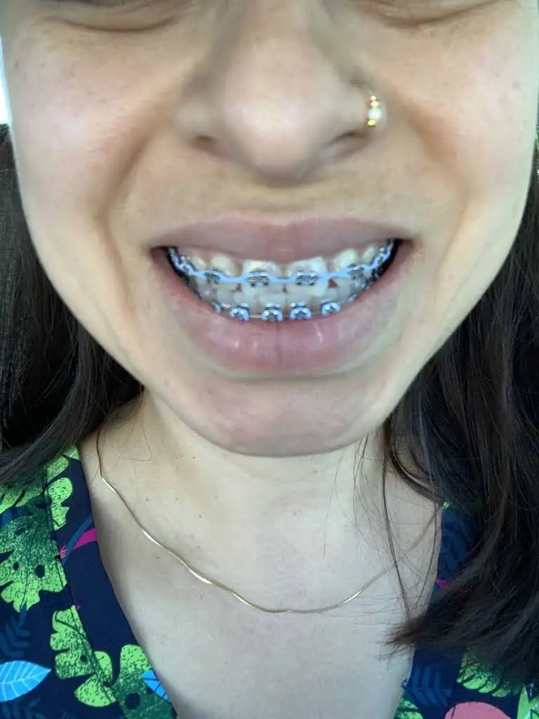 Flynn Orthodontics