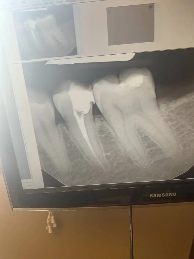SOLANKI ENDODONTICS