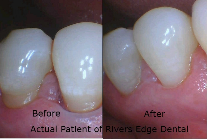 Rivers Edge Dental