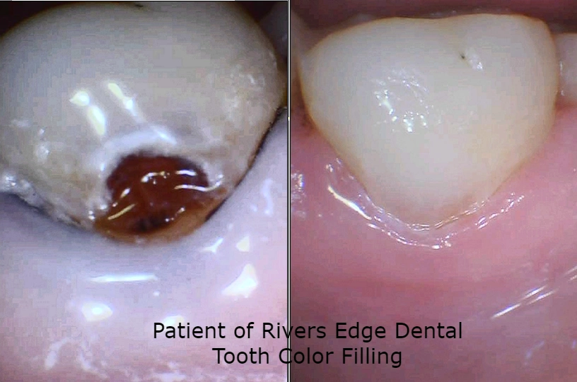 Rivers Edge Dental