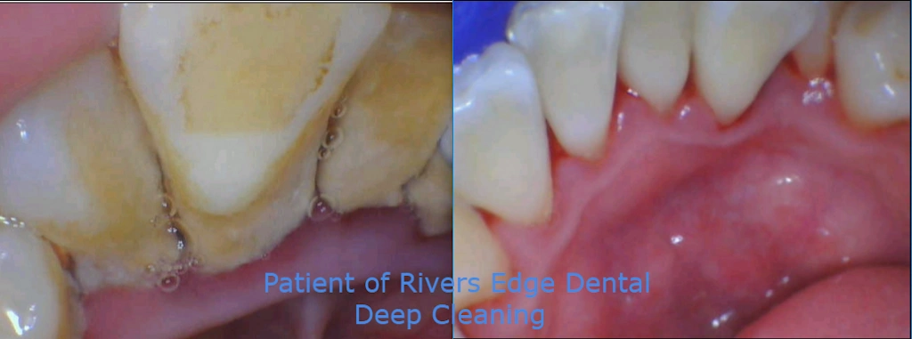 Rivers Edge Dental