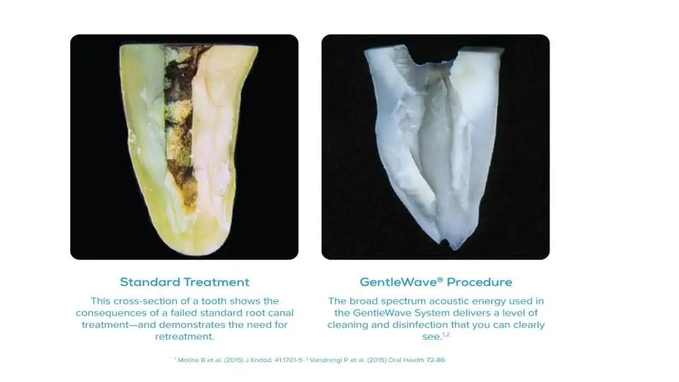 Elevate Endodontics