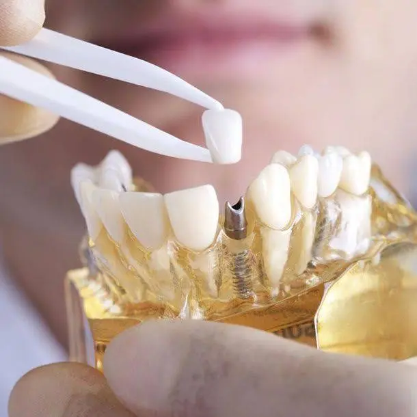 Stubbs Dental Implant Center