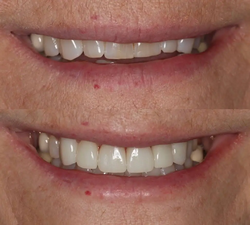 Peak Dental Utah