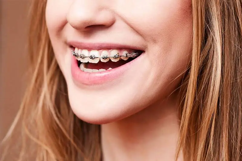 Smile Town Dental