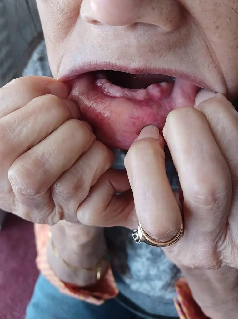Affordable Dentures & Implants