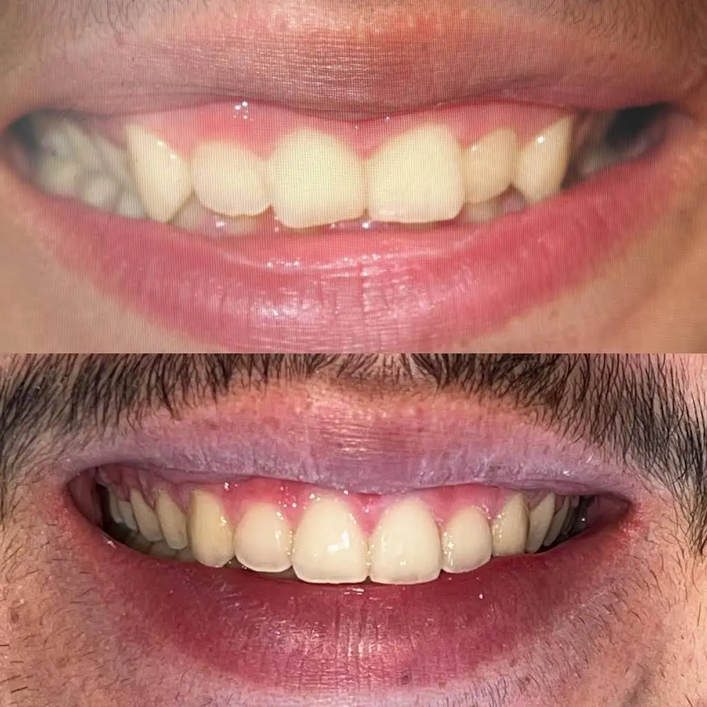 Holt Dental Care