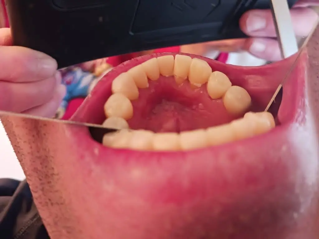 Young Family Dental