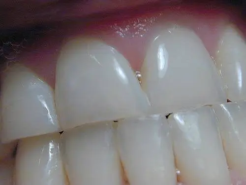 Alpenglow Dental