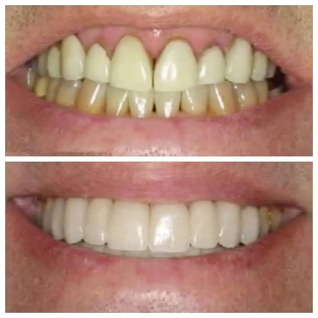 The Fort Union Dentist