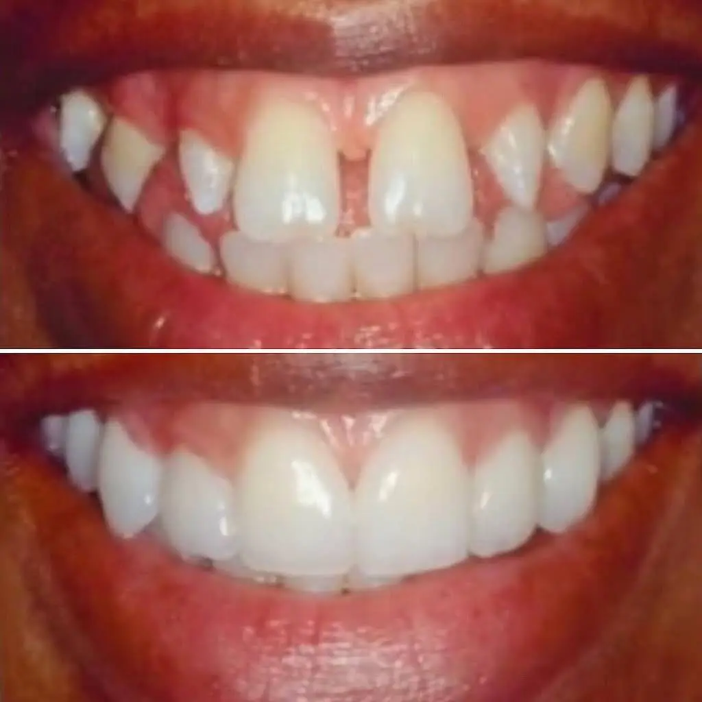 The Fort Union Dentist