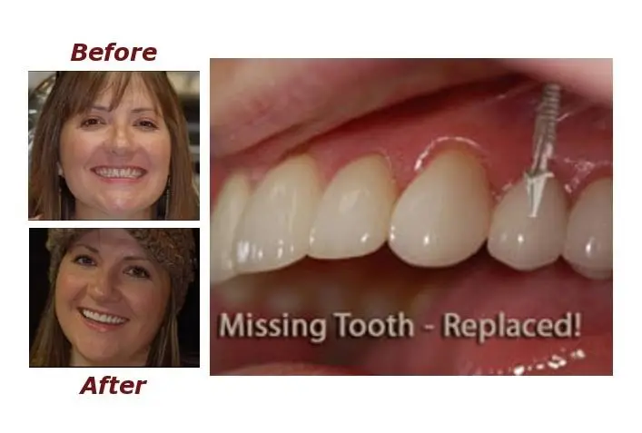 Artisan Dental