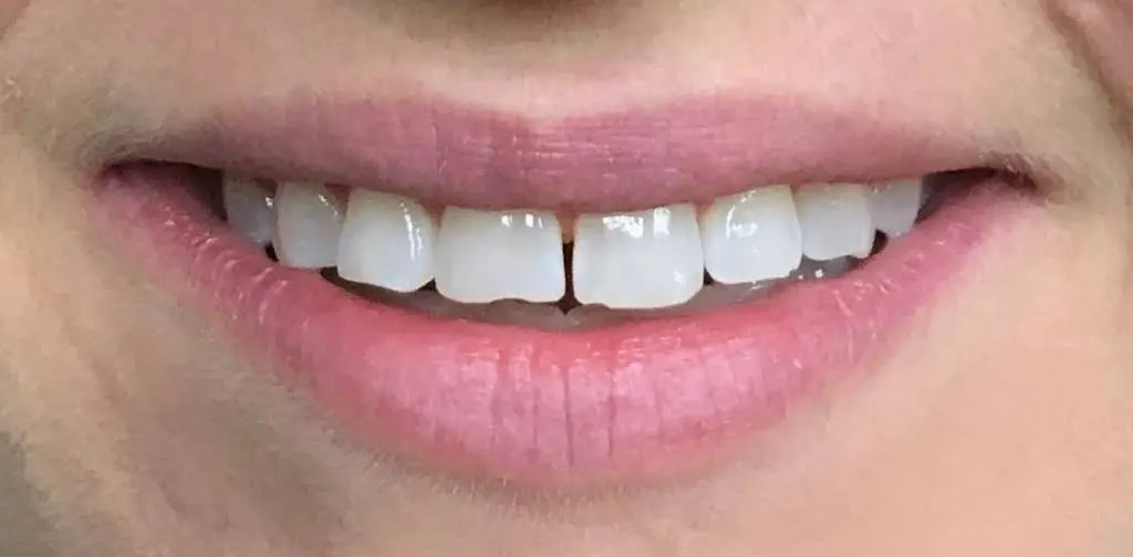Artisan Dental