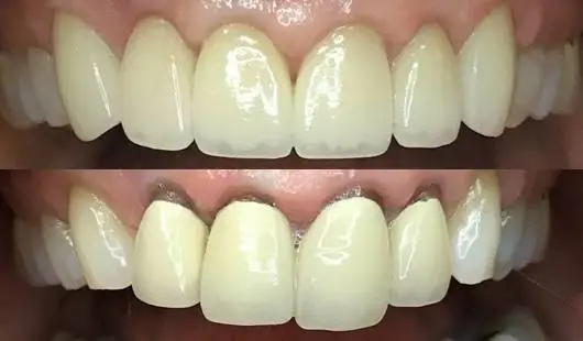 Meadowbrook Dental