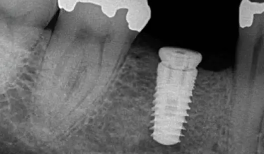 Meadowbrook Dental