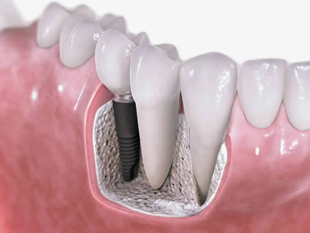 Smiles 4U Dental