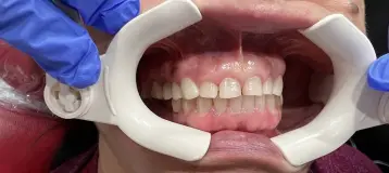 NLV Dental