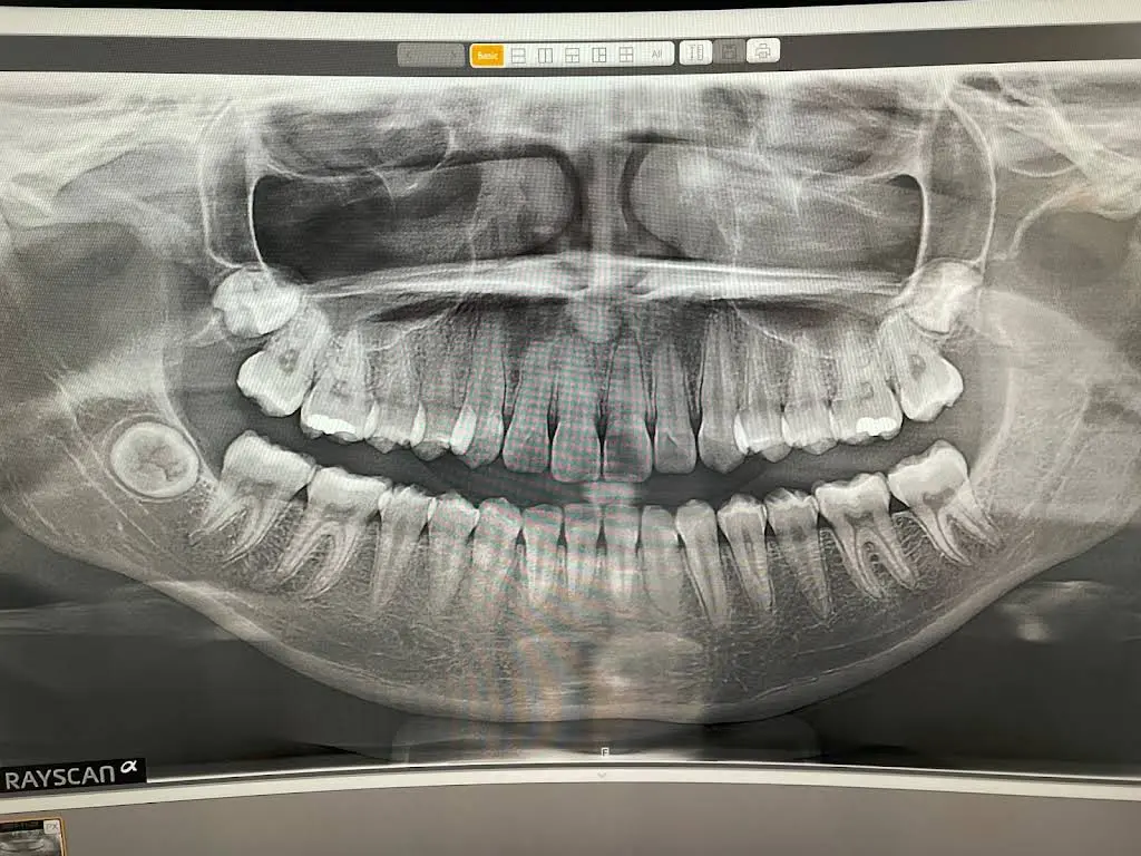NLV Dental