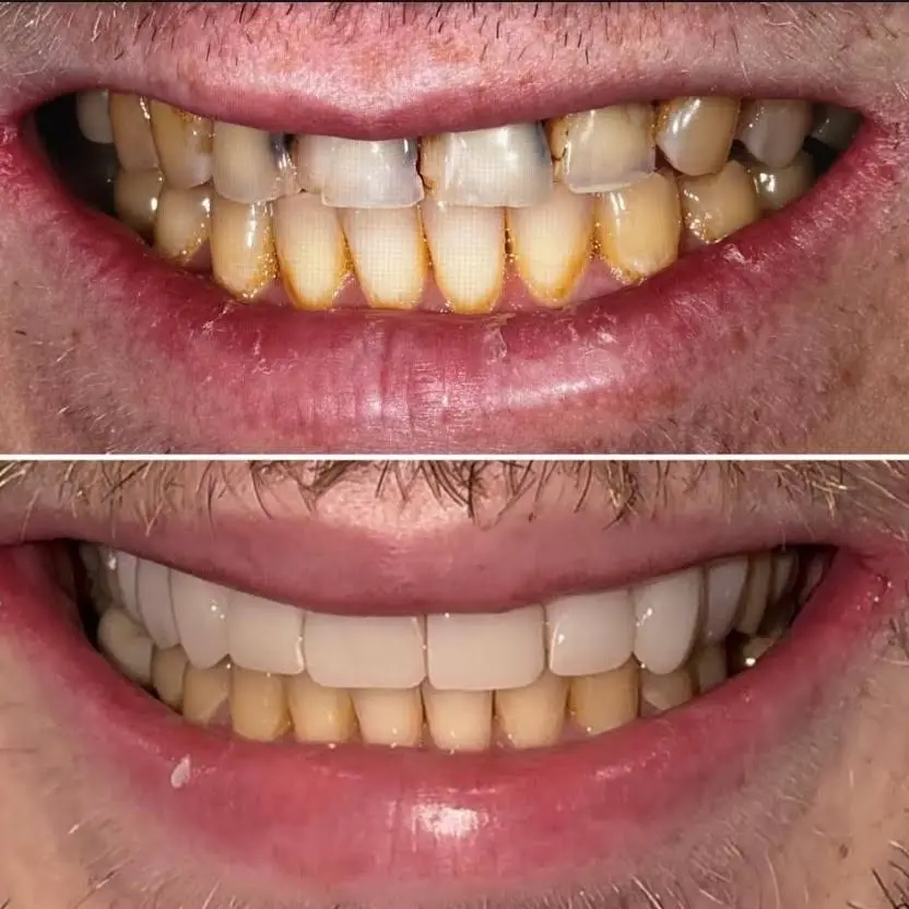 NLV Dental