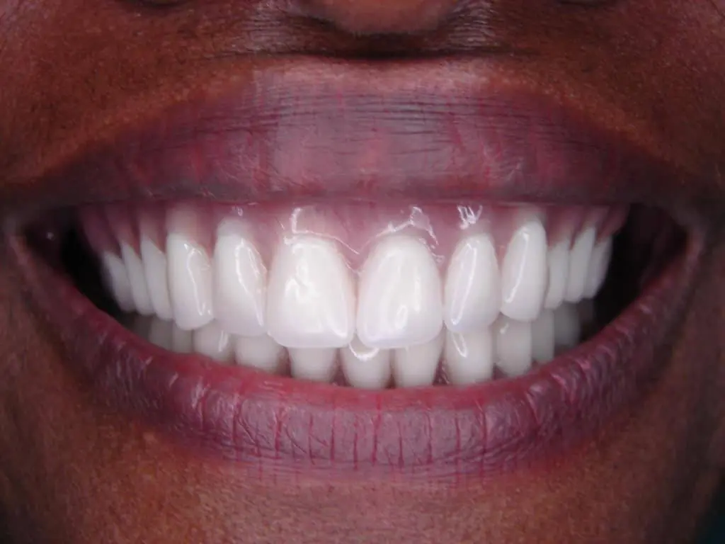 All Smiles Family Dentistry