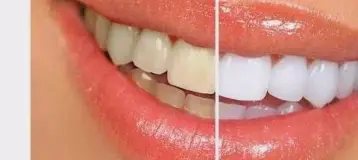 Gregory Perkins DDS