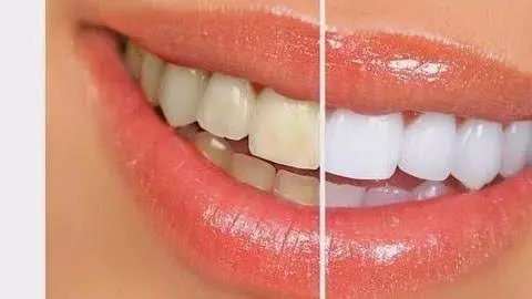 Gregory Perkins DDS