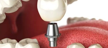 Holladay Hills Dental