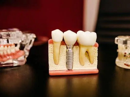 Glenbard Family Dental
