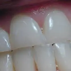 Alpenglow Dental