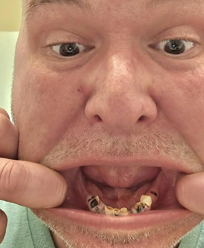 Nuvia Dental Implant Center