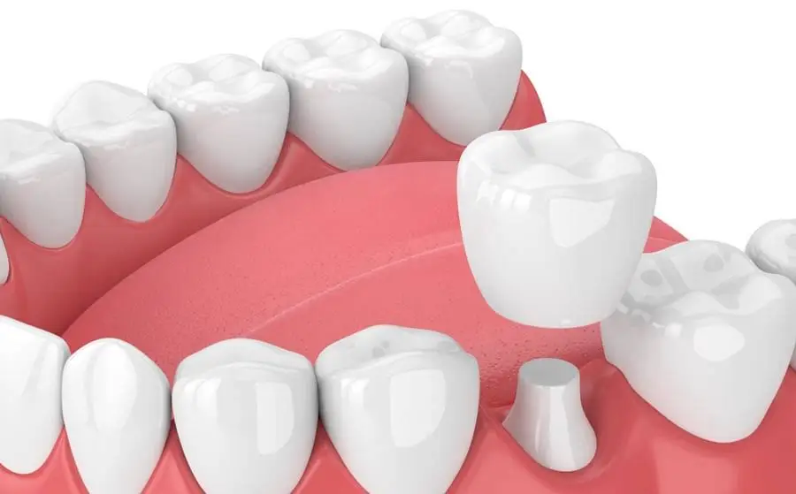 Highland Heights Dental