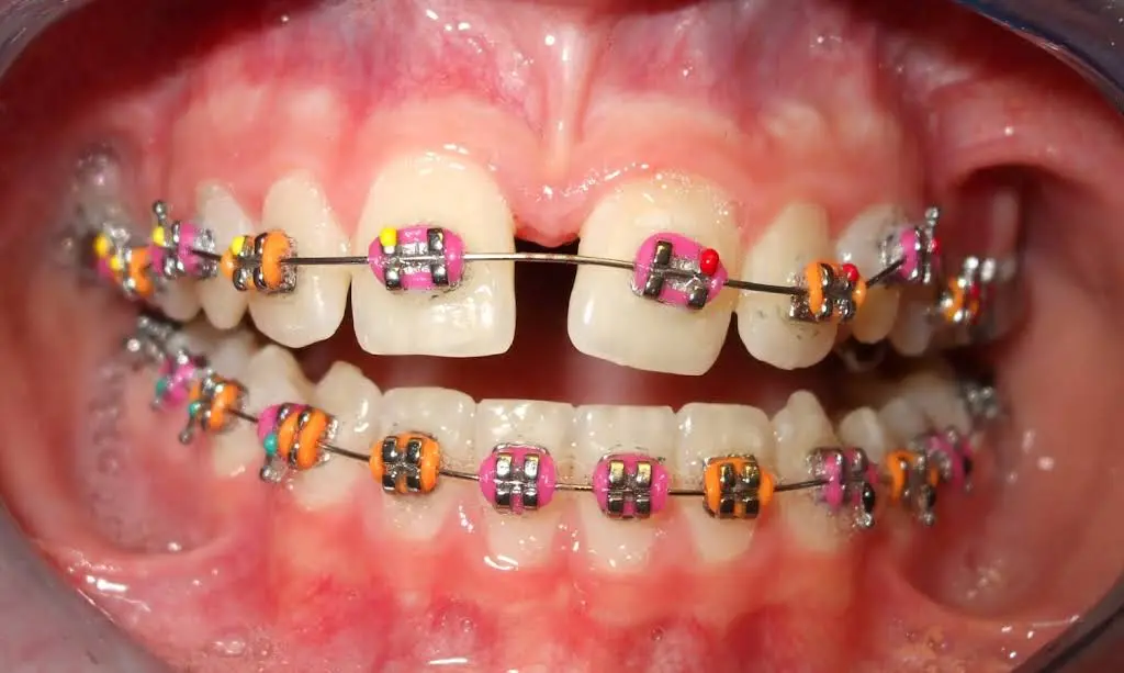 Premier Orthodontics & Dental Specialists
