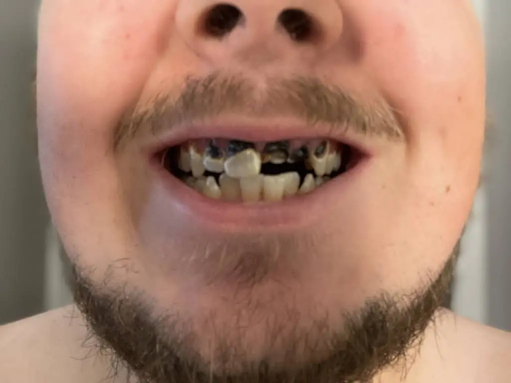 Aspen Dental