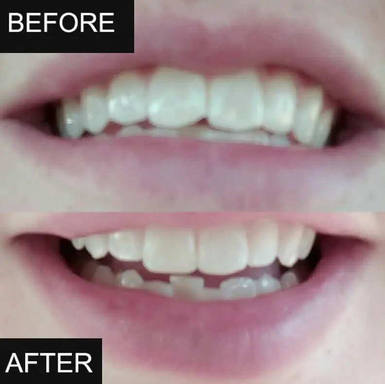 B. Kent Bladen, DDS