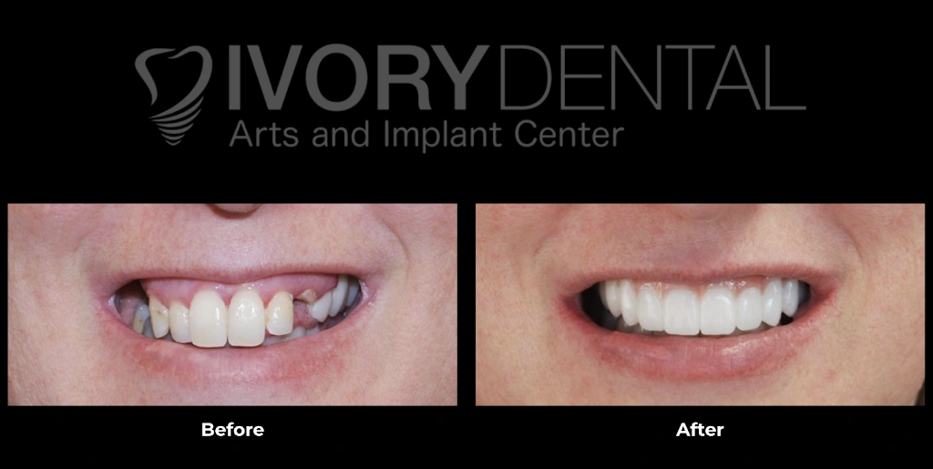 Ivory Dental Arts and Implant Center