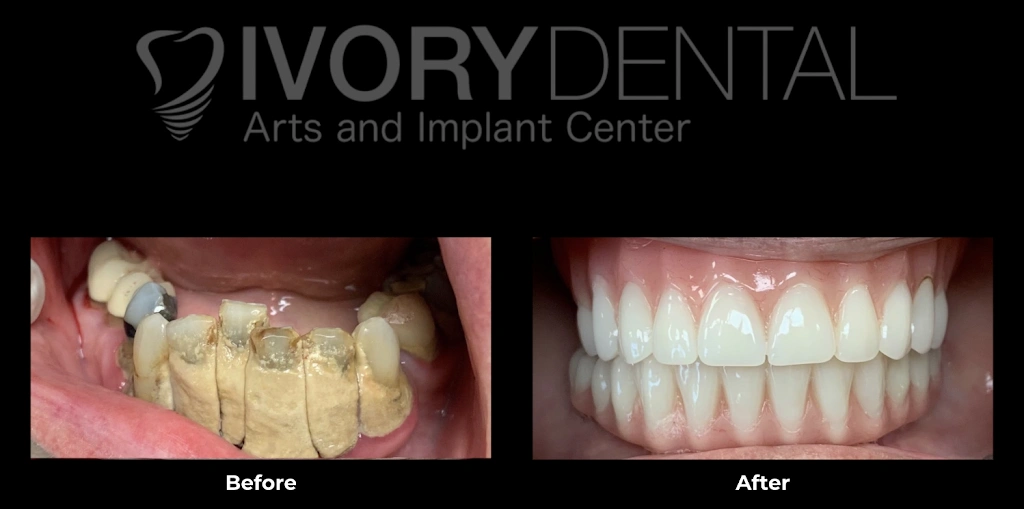 Ivory Dental Arts and Implant Center