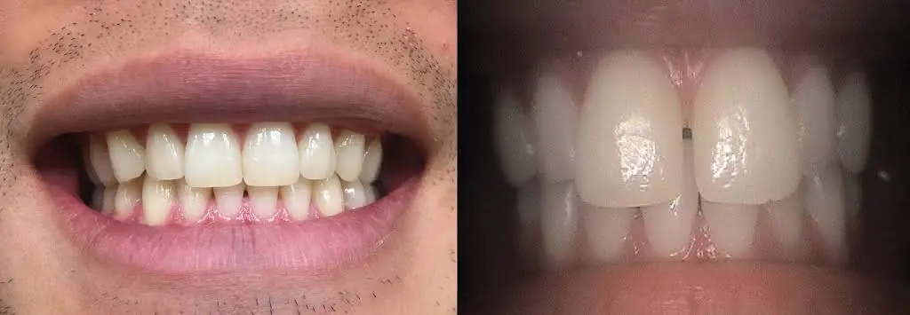 Oquirrh Mountain Dental