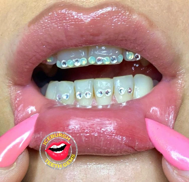 IceBurgh Teeth Gems