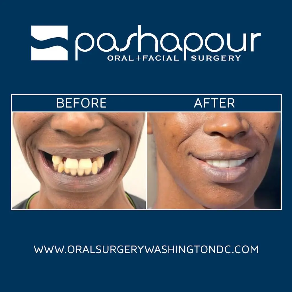Pashapour Oral + Facial Surgery