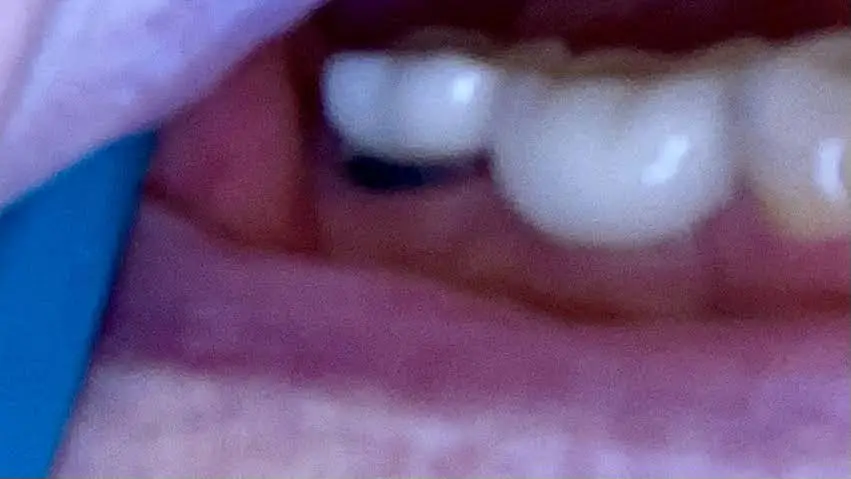 The Center for Dental Implants