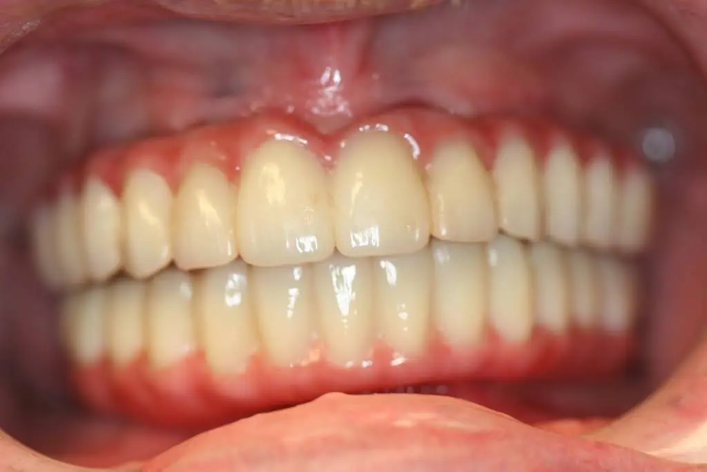 The Center for Dental Implants