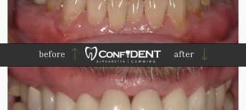 ConfiDENT Dental