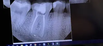 Cumming Endodontics