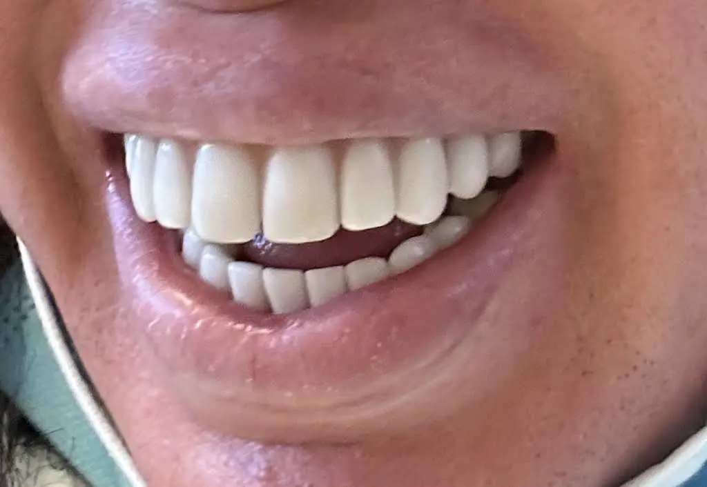 Sedation and Implant Dentistry Las Vegas