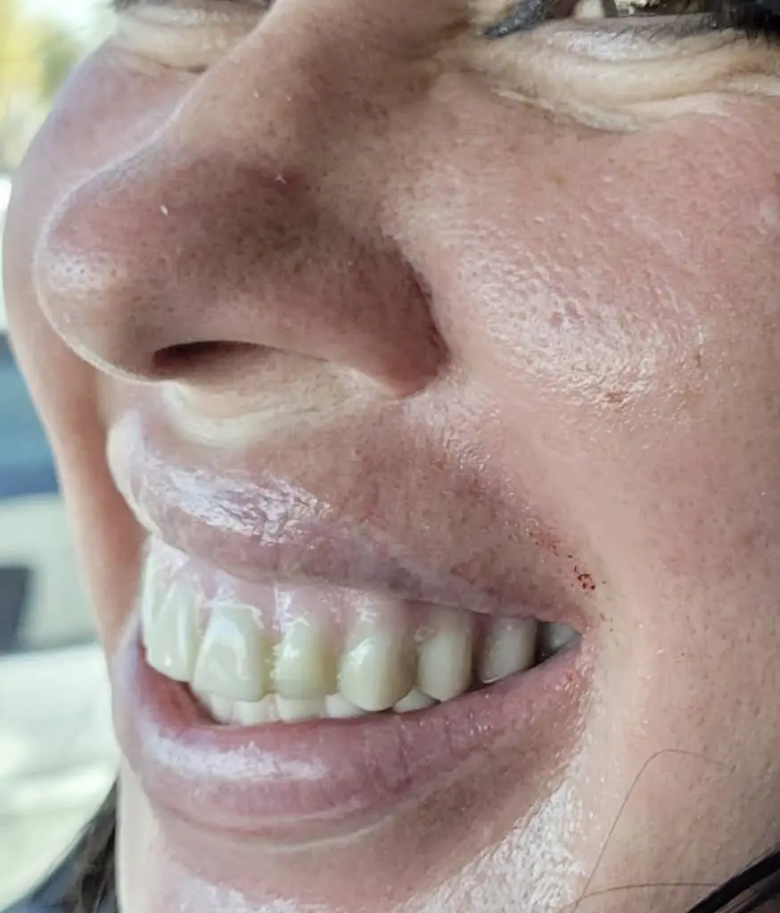 Sedation and Implant Dentistry Las Vegas