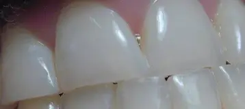 Alpenglow Dental
