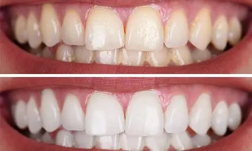 Valley Smile Solutions